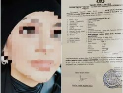 *Terlapor Kasus Dokter Gigi Spesialis Orthodonti Asal Surabaya Beku 9 Bulan, “SDM Unit Tipidter” Jalan Di Tempat Patut Dipertayakan